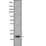 Eotaxin Antibody in Western Blot (WB)