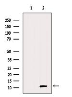 MIP-3 beta Polyclonal Antibody