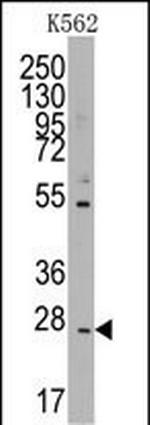 CD8 beta Antibody in Western Blot (WB)