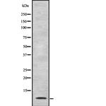MDC Polyclonal Antibody