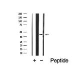 CCR5 Polyclonal Antibody