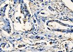 SIX2 Polyclonal Antibody