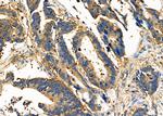 CD166 Antibody in Immunohistochemistry (Paraffin) (IHC (P))