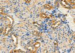CD166 Antibody in Immunohistochemistry (Paraffin) (IHC (P))