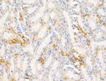 CD1a Antibody in Immunohistochemistry (Paraffin) (IHC (P))