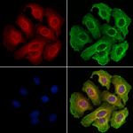 CD20 Antibody in Immunocytochemistry (ICC/IF)