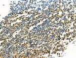 CD20 Antibody in Immunohistochemistry (Paraffin) (IHC (P))