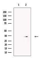 CD20 Antibody in Western Blot (WB)