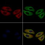 CD248 Polyclonal Antibody