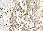 CD248 Antibody in Immunohistochemistry (Paraffin) (IHC (P))