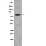 CD248 Antibody in Western Blot (WB)