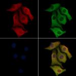 CD69 Antibody in Immunocytochemistry (ICC/IF)