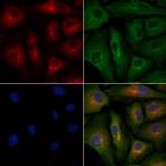 CD7 Polyclonal Antibody