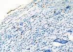 CD8 Antibody in Immunohistochemistry (Paraffin) (IHC (P))