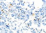 CD8 Antibody in Immunohistochemistry (Paraffin) (IHC (P))