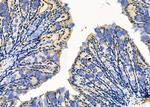 CD80 Antibody in Immunohistochemistry (Paraffin) (IHC (P))