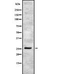 CD81 Antibody in Western Blot (WB)