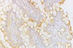 CD8 Antibody in Immunohistochemistry (Paraffin) (IHC (P))