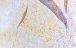 CD8 Antibody in Immunohistochemistry (Paraffin) (IHC (P))