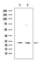 CD8 Antibody in Western Blot (WB)