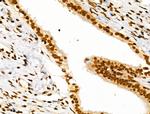 CDK8 Polyclonal Antibody