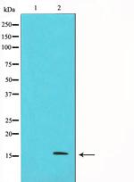 p16INK4a Polyclonal Antibody