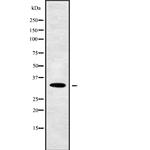 CENPQ Polyclonal Antibody