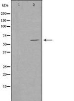 CERKL Polyclonal Antibody