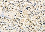 CHD1L Polyclonal Antibody