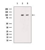 CHD1L Antibody in Western Blot (WB)
