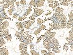 CHD4 Antibody in Immunohistochemistry (Paraffin) (IHC (P))