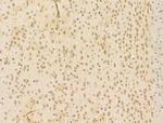 CHD4 Antibody in Immunohistochemistry (Paraffin) (IHC (P))