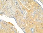 CHL1 Antibody in Immunohistochemistry (Paraffin) (IHC (P))