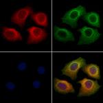 CHRM4 Polyclonal Antibody