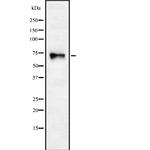 CHRNA4 Polyclonal Antibody