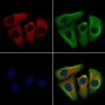 Chymotrypsin Polyclonal Antibody