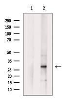 Chymotrypsin Antibody in Western Blot (WB)