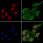 CIDEA Polyclonal Antibody