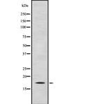CITED4 Polyclonal Antibody