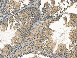 Clathrin Heavy Chain Antibody in Immunohistochemistry (Paraffin) (IHC (P))