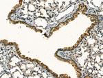 Clathrin Heavy Chain Antibody in Immunohistochemistry (Paraffin) (IHC (P))