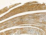 Clathrin Heavy Chain Antibody in Immunohistochemistry (Paraffin) (IHC (P))