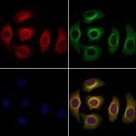 CLCA3P Polyclonal Antibody