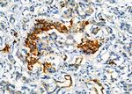 CLPP Polyclonal Antibody