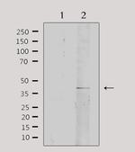 Collagen IV Polyclonal Antibody