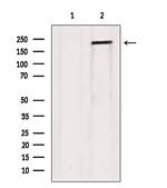 Collagen V Polyclonal Antibody