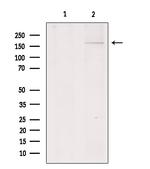COL11A1 Polyclonal Antibody