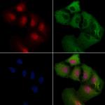 COPS2 Polyclonal Antibody