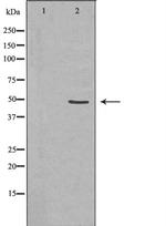 CD116 Polyclonal Antibody