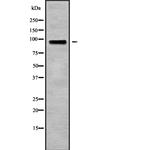 CSF3R Polyclonal Antibody